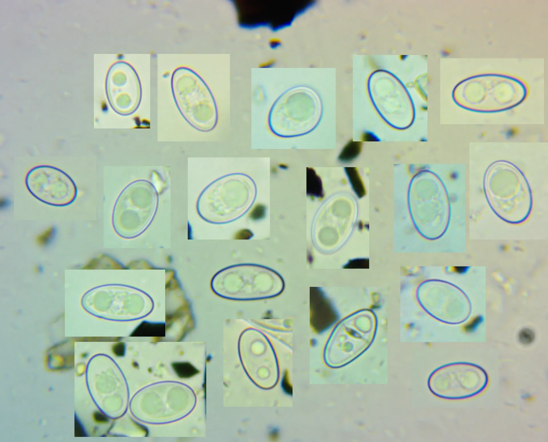 Trichophaea abundans esporas